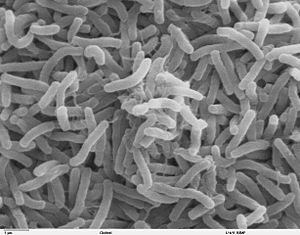 コレラ菌写真1|食中毒.e840net